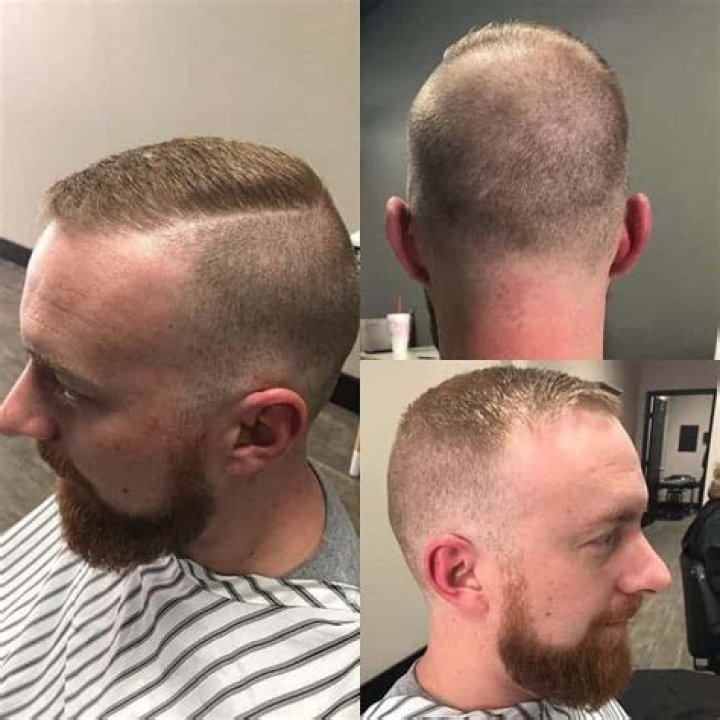 ___-over (one way to hide a bald spot)